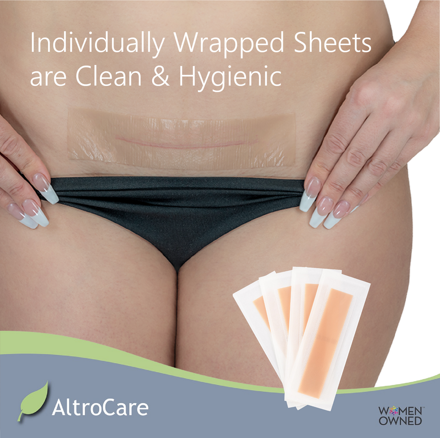 C-Section Scar Sheets