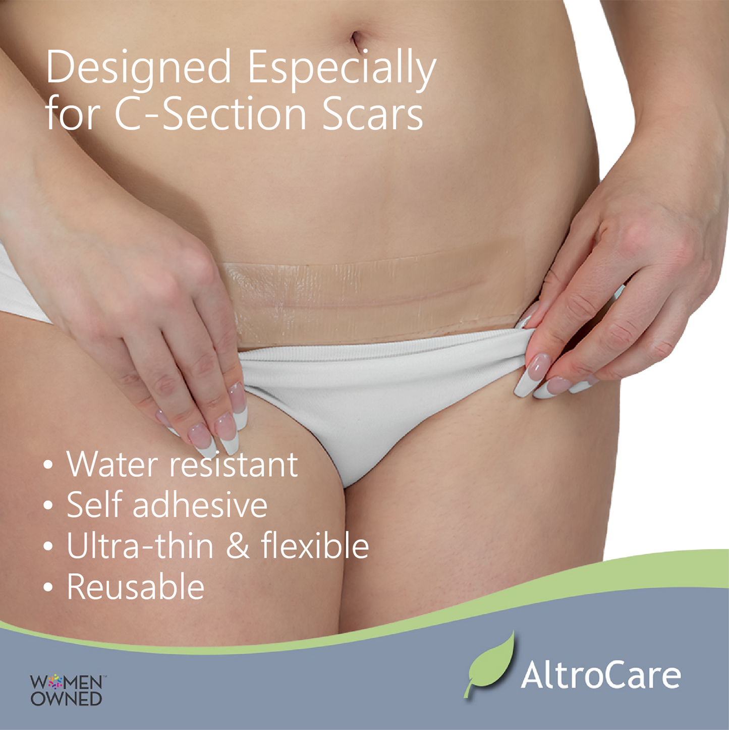 C-Section Scar Sheets (Case of 25 packs)
